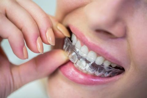 Invisible Dental Braces Guide: Tips, Insights & Facts