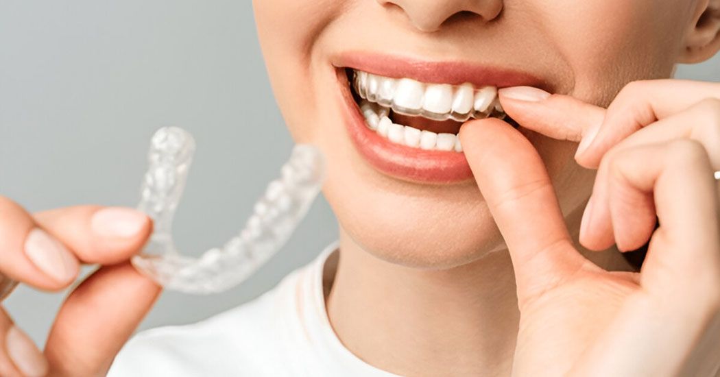 Invisible Dental Braces 